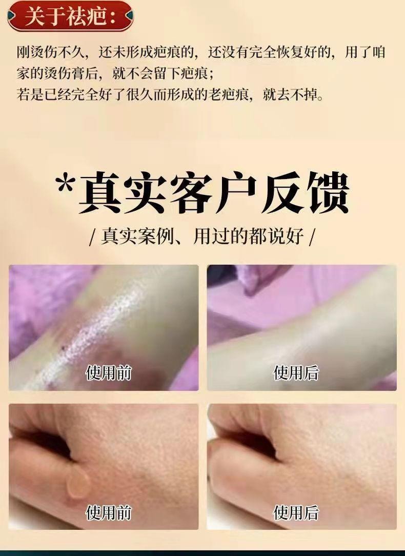 祥医堂 獾油烫伤膏15g/盒 修护皮肤、止痛消肿、温和舒缓、烫伤烧伤疤痕膏