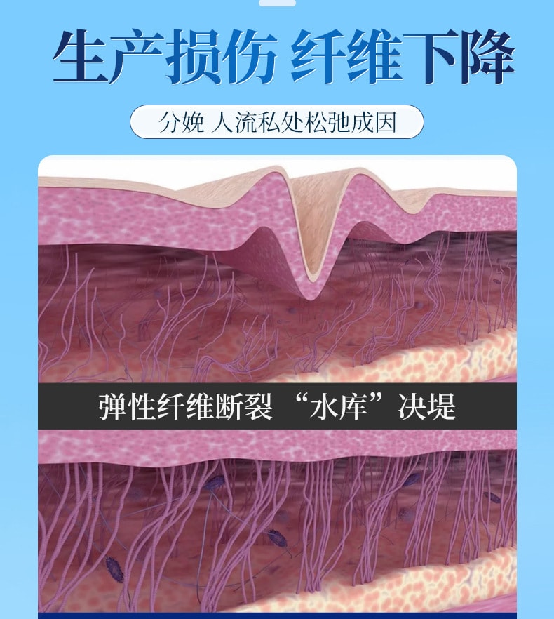 舒奈美 緊潤丹縮宮收陰神器私處鬆弛道女性水潤抑菌凝膠緊潤私密處收縮緊緻棒 10粒/盒