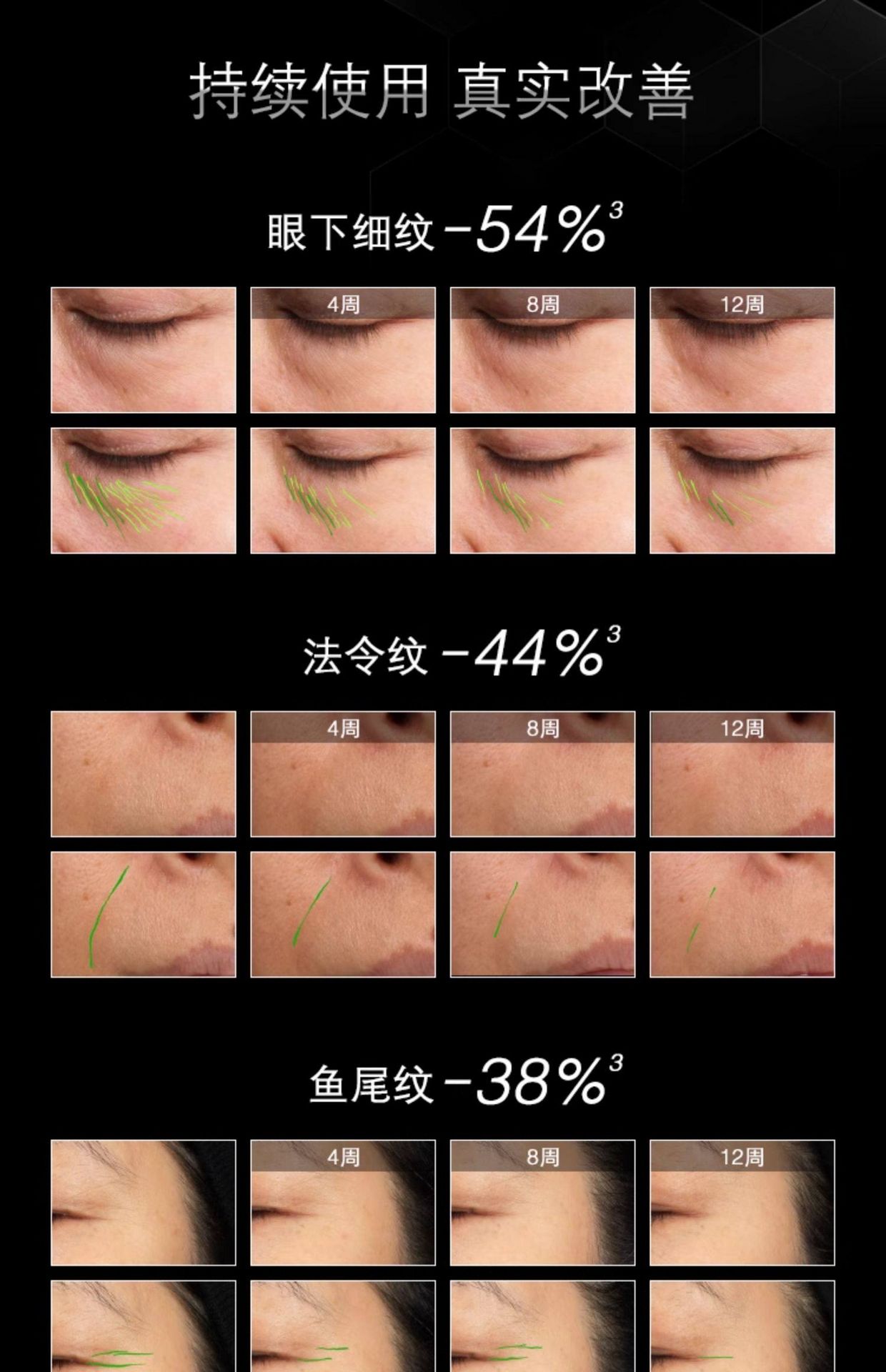 【香港直邮】 美国 SKINCEUTICALS修丽可 修丽可 多肽抗皱精华液P-TIOX 30ML 淡纹紧致 深层保湿 胜肽修护 改善细纹 医美级抗老精华