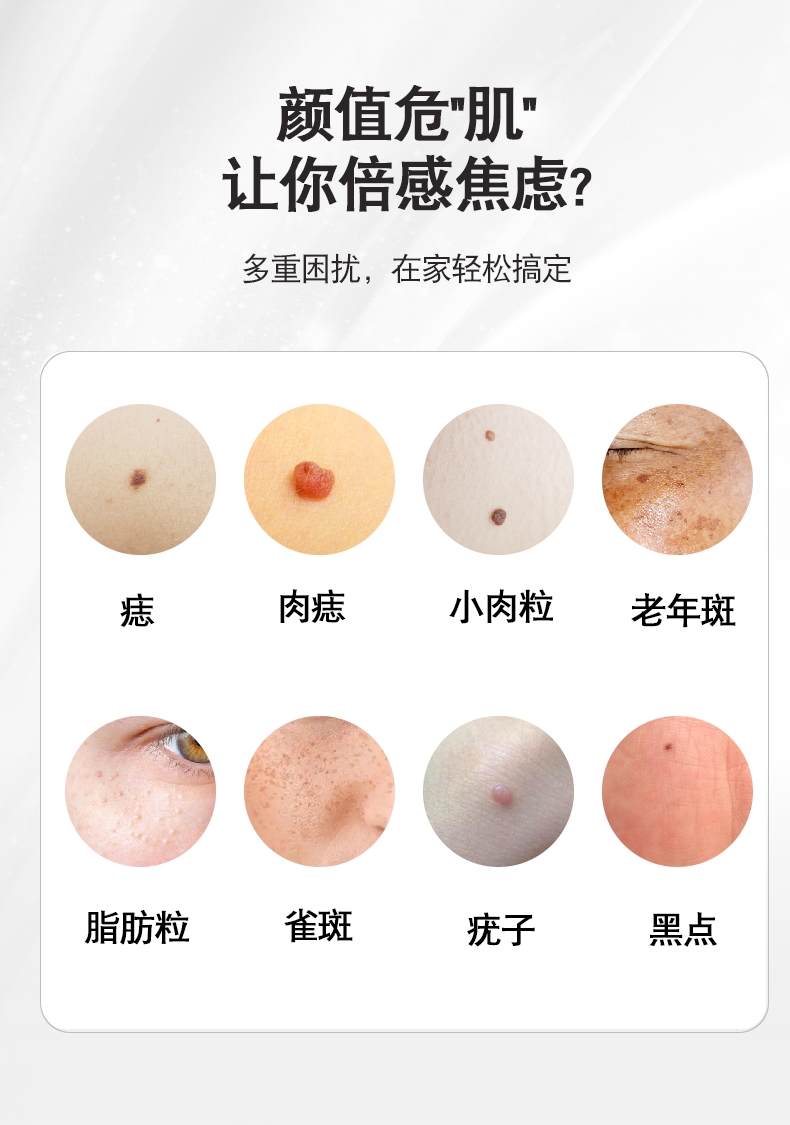 祥医堂 激光点去扁平疣仪器针神器去除点痣笔膏面部脖子祛瘊子肉粒疙瘩猴 - Weee!