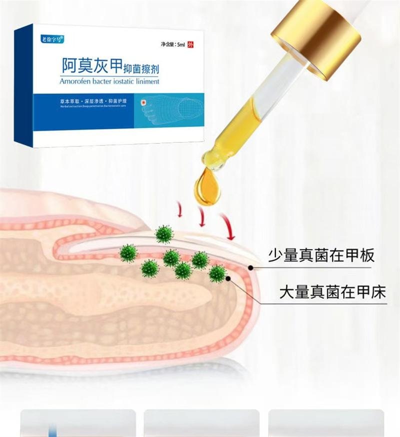 祥医堂 灰指甲专用液体 阿莫罗芬灰甲搽剂乳膏软膏5ml