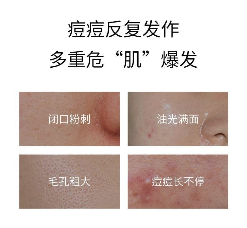 稚漾 壬二酸淨顏凝露水楊酸細緻毛孔霜去黑頭緊緻毛孔 淨顏凝露30g+毛孔細緻霜30g(限時低價促銷)