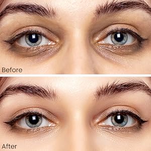 before and after