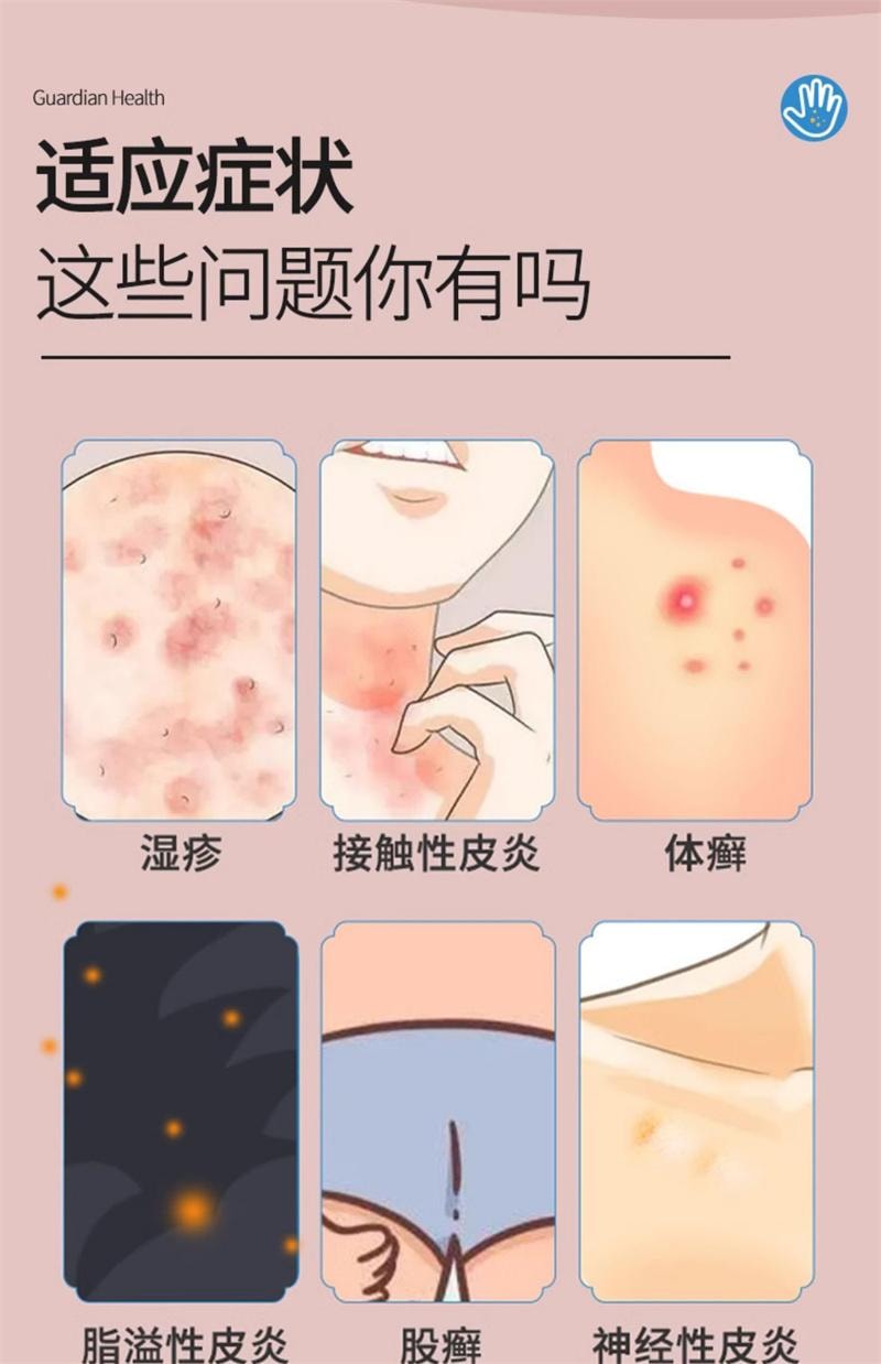廣藥白雲山 外用皮炎溼疹體股癬手足癬皮膚瘙癢止癢藥膏 曲咪新乳膏10g