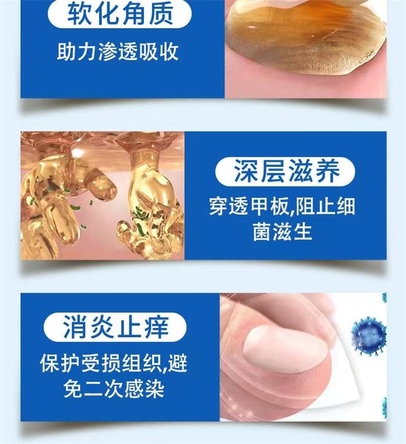 祥医堂 灰指甲专用液体 阿莫罗芬灰甲搽剂乳膏软膏5ml