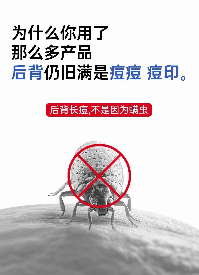 【中國直郵】  麗芙 克林黴素磷酸酯外用溶液 毛囊炎前胸後背祛痘噴霧背部祛痘除蟎 30ml/瓶