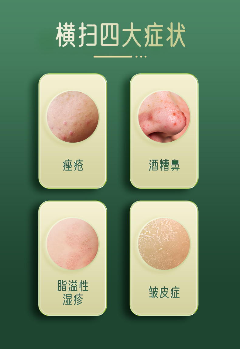 999 维生素B6软膏  祛痘 去黑头 皮炎湿疹  酒糟鼻   20g/盒