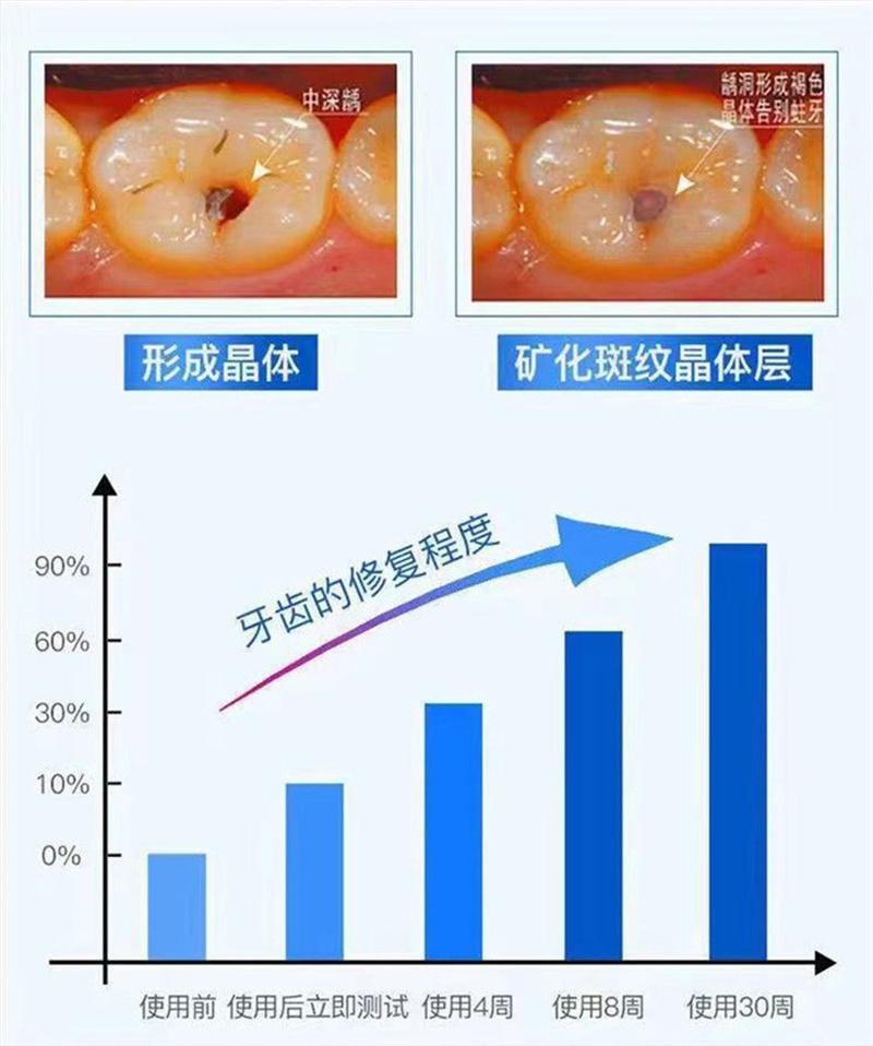 香港大藥房 再生硅牙膏120g/盒 護齦固齡防蛀去牙結石抗牙敏感