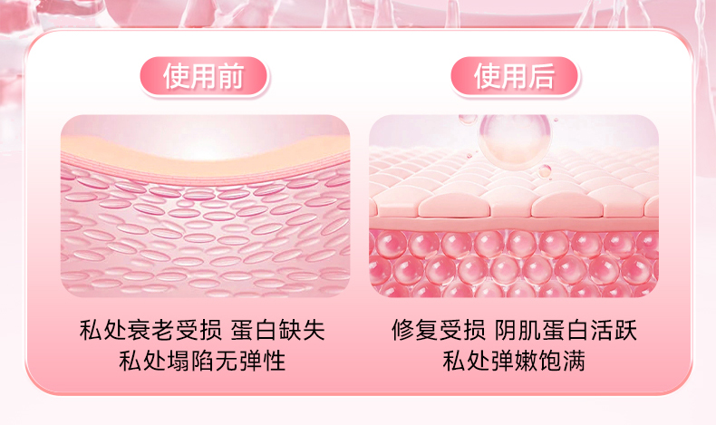 【中國直郵】北京同仁堂  醫用婦科凝膠  私處緊緻 增加彈性 緊緻水潤  1盒