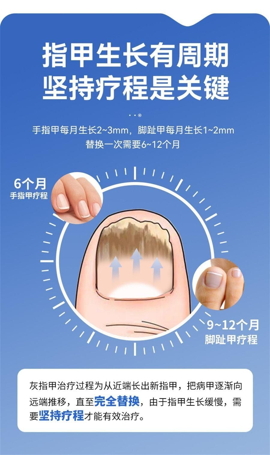 【中國直郵】 洛芙 鹽酸阿莫羅芬搽劑 灰指甲灰指甲抗菌液抑菌阿羅莫芬 5%*2ml/1盒