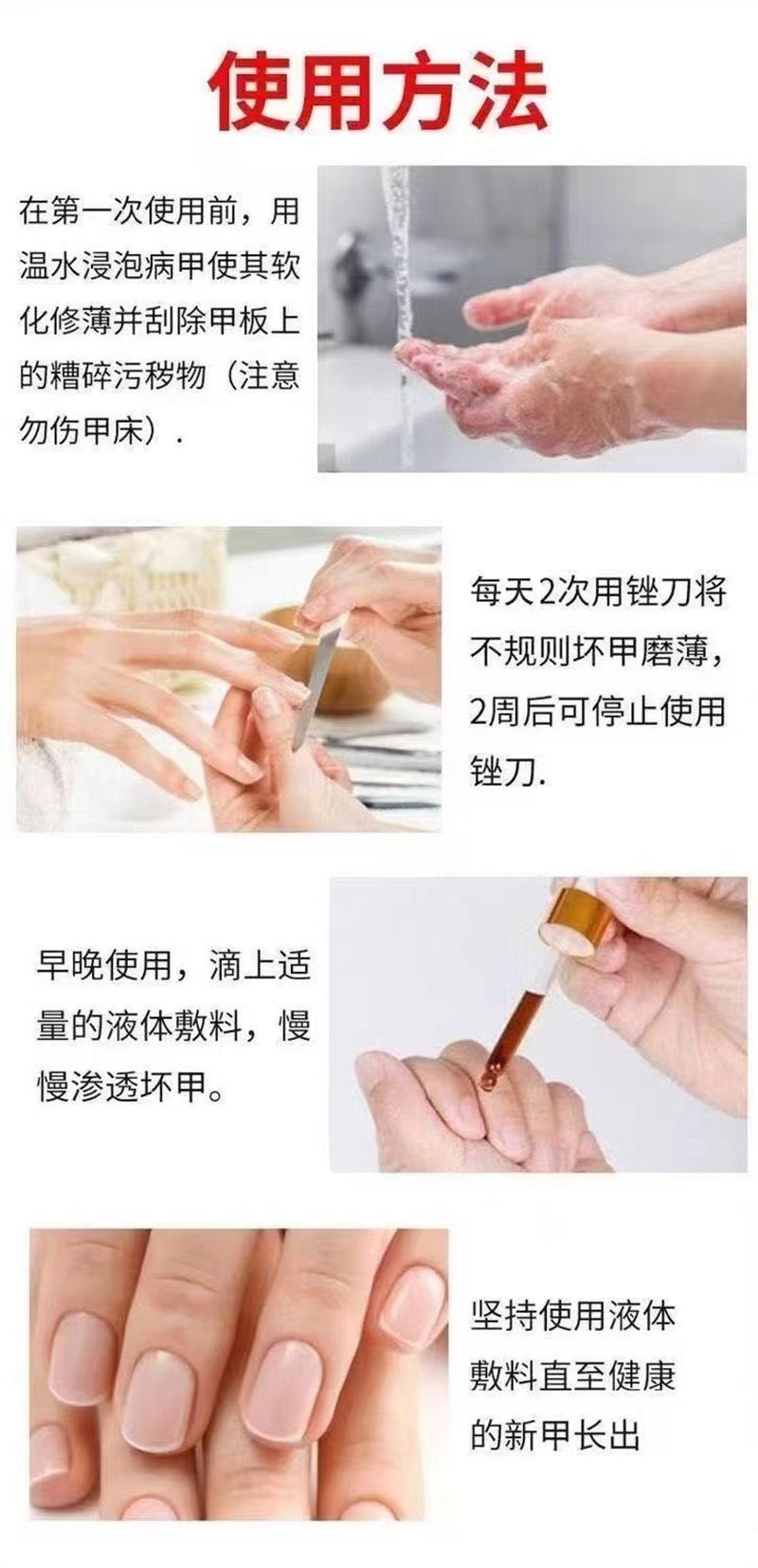 祥医堂 灰指甲专用液体 阿莫罗芬灰甲搽剂乳膏软膏5ml