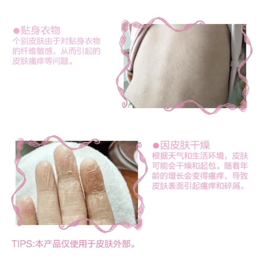 【日本直邮】小林制药女性私处外阴止痒抗炎软膏万能止痒膏抑菌消除红肿30g