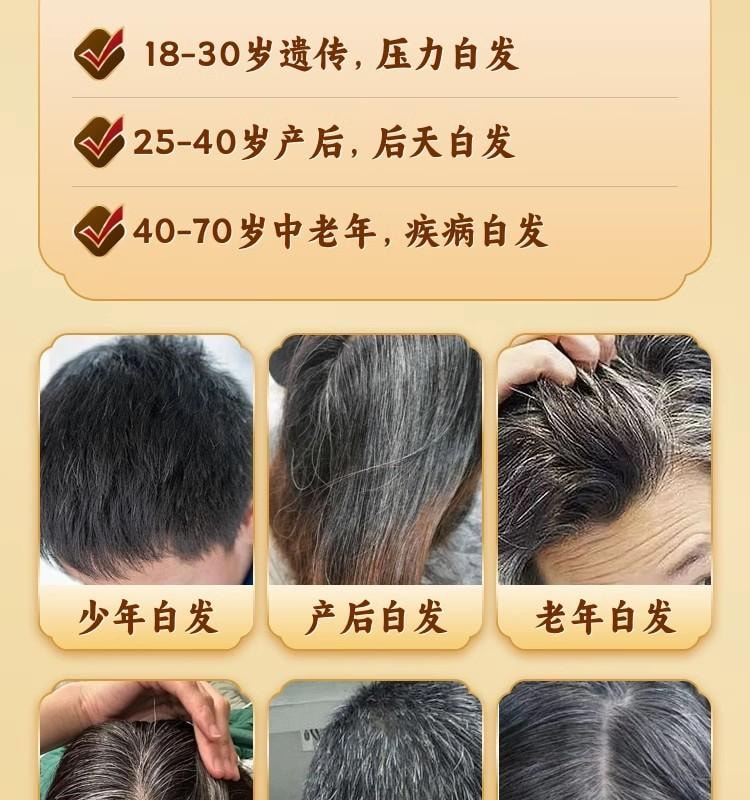 【中國直郵】 正大 佐今明 七寶美髯口服液10ml*10支/盒 補肝腎 烏鬚髮