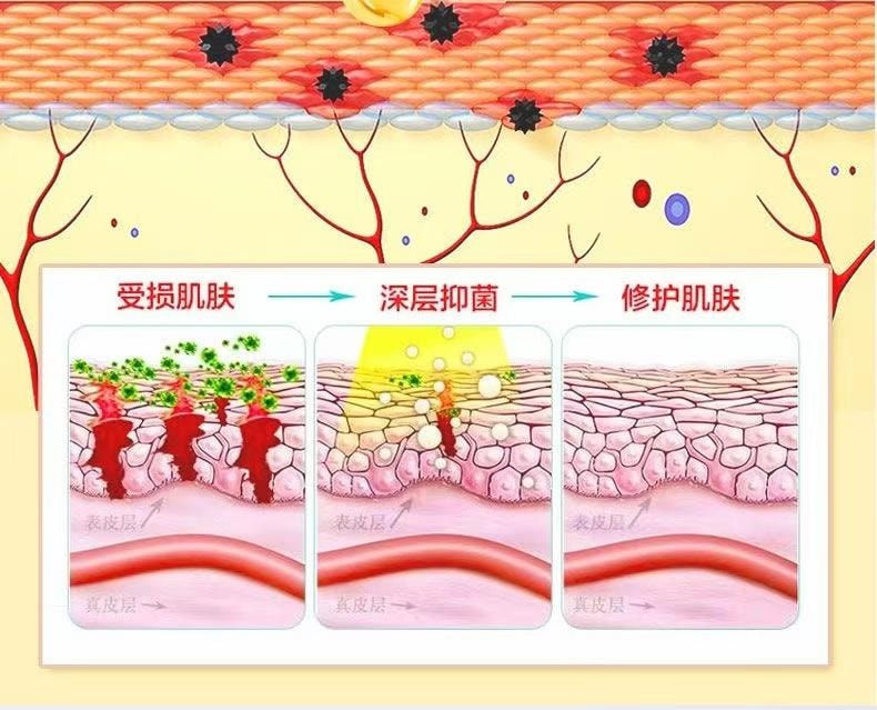  祥醫堂 癤腫消腫植物草本乳膏溫和乳膏止痛拔膿皮膚外用止癢抑菌 魚石脂軟膏20g