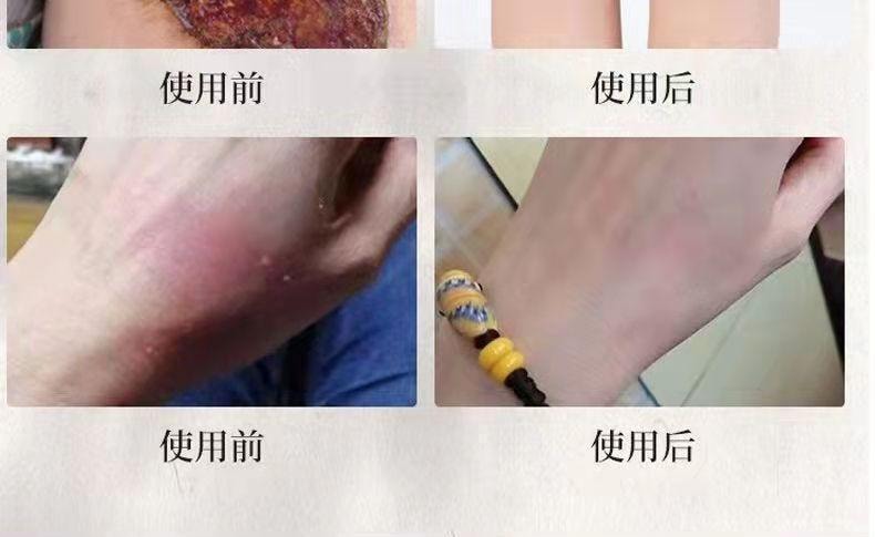 祥医堂 獾油烫伤膏15g/盒 修护皮肤、止痛消肿、温和舒缓、烫伤烧伤疤痕膏