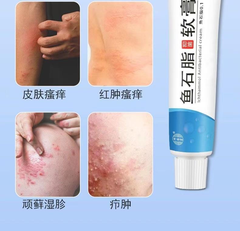  祥醫堂 癤腫消腫植物草本乳膏溫和乳膏止痛拔膿皮膚外用止癢抑菌 魚石脂軟膏20g