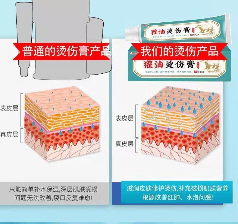 祥医堂 獾油烫伤膏15g/盒 修护皮肤、止痛消肿、温和舒缓、烫伤烧伤疤痕膏