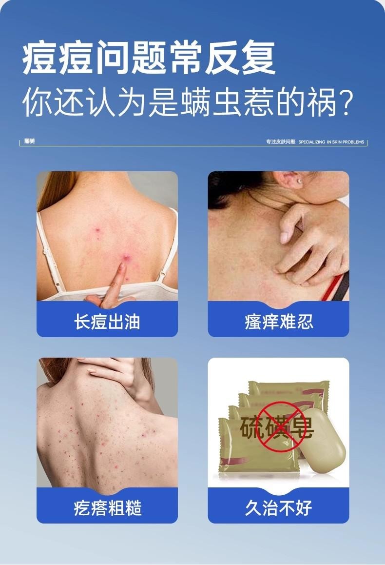 【中國直郵】  麗芙 克林黴素磷酸酯外用溶液 毛囊炎前胸後背祛痘噴霧背部祛痘除蟎 30ml/瓶