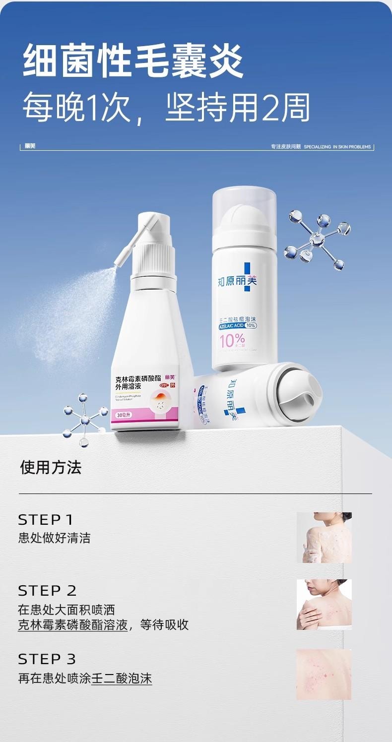 【中國直郵】  麗芙 克林黴素磷酸酯外用溶液 毛囊炎前胸後背祛痘噴霧背部祛痘除蟎 30ml/瓶