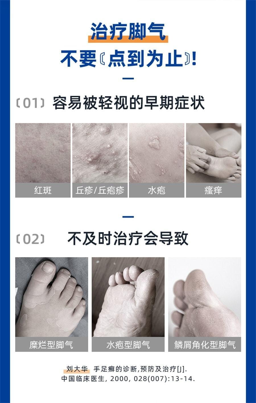 999 盐酸特比萘芬喷雾剂 治疗脚气的专用药 止痒脱皮杀菌去脚臭水泡 35ml/盒(医师推荐拍3瓶)