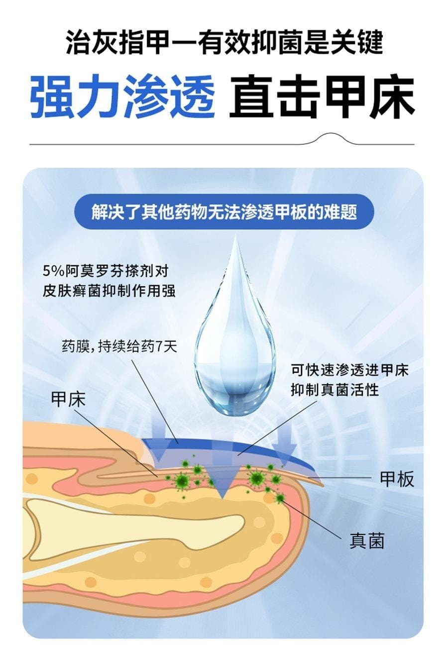 【中國直郵】 洛芙 鹽酸阿莫羅芬搽劑 灰指甲灰指甲抗菌液抑菌阿羅莫芬 5%*2ml/1盒