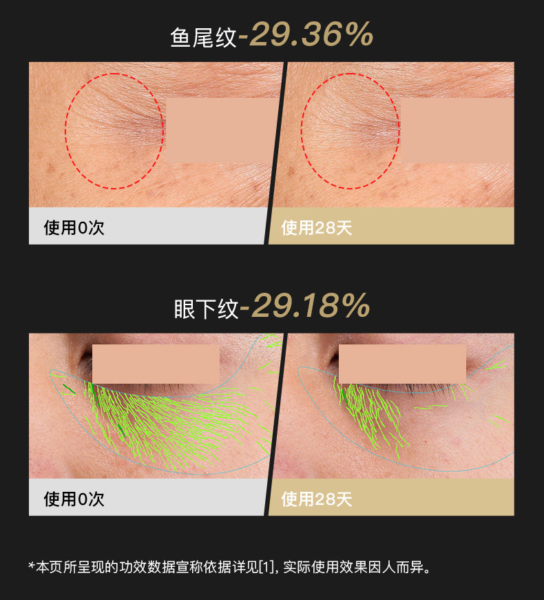 【日本直郵】新款YAMAN雅萌小膜王美眼儀 家用淡黑淡紋緊緻提拉魚尾紋美容儀