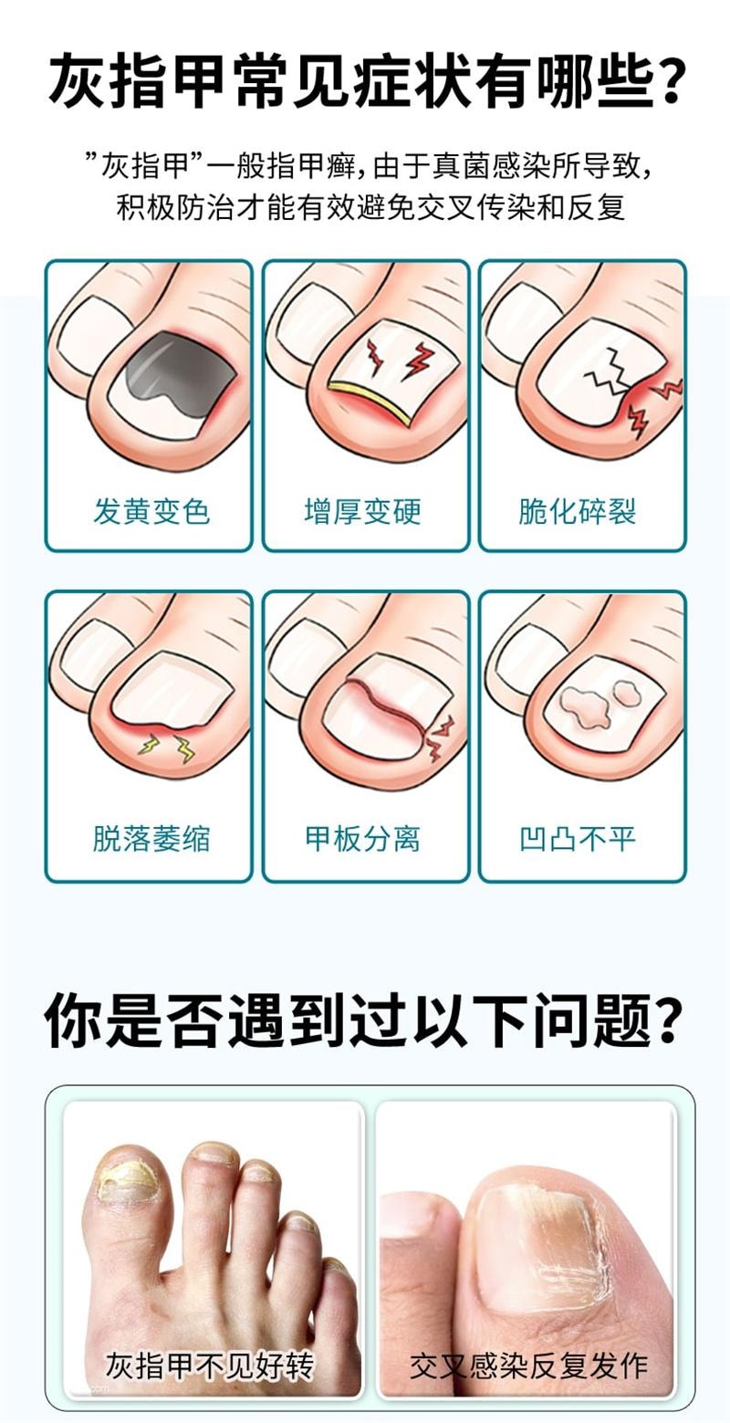 【中国直邮】 洛芙 环吡酮胺乳膏 抑制真菌 强力渗透 治疗灰指甲专用药 15g x 1盒