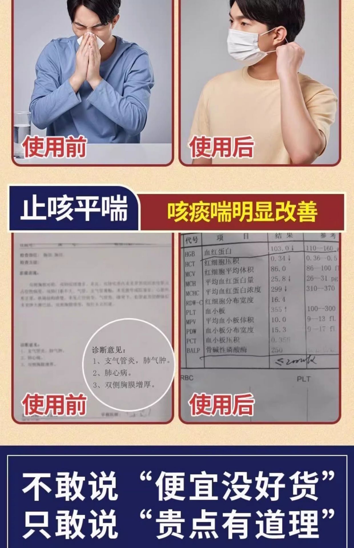 济药苓桂咳喘宁胶囊 2 盒 - Weee!