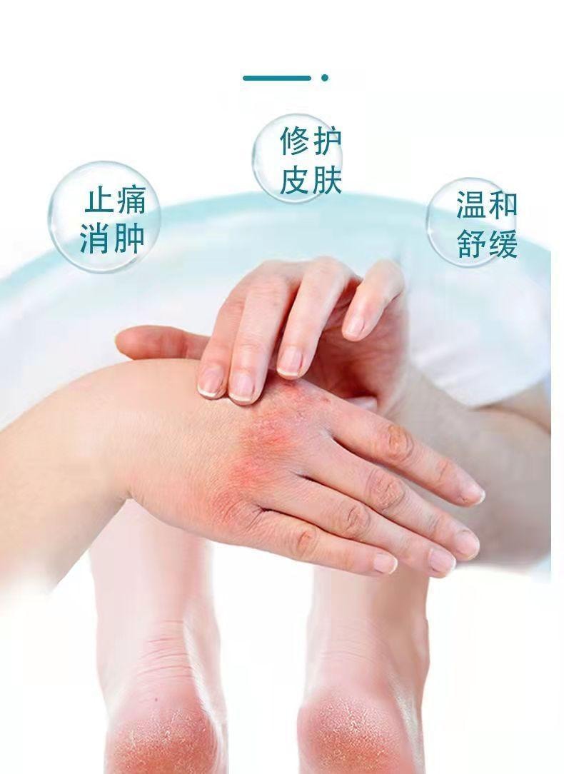 祥医堂 獾油烫伤膏15g/盒 修护皮肤、止痛消肿、温和舒缓、烫伤烧伤疤痕膏