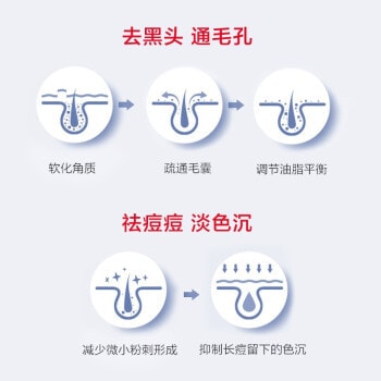 质润 15%壬二酸凝胶 5g 祛痘淡化痘印 去黑头粉刺 控油修护舒缓肌肤 适用所有肤质 