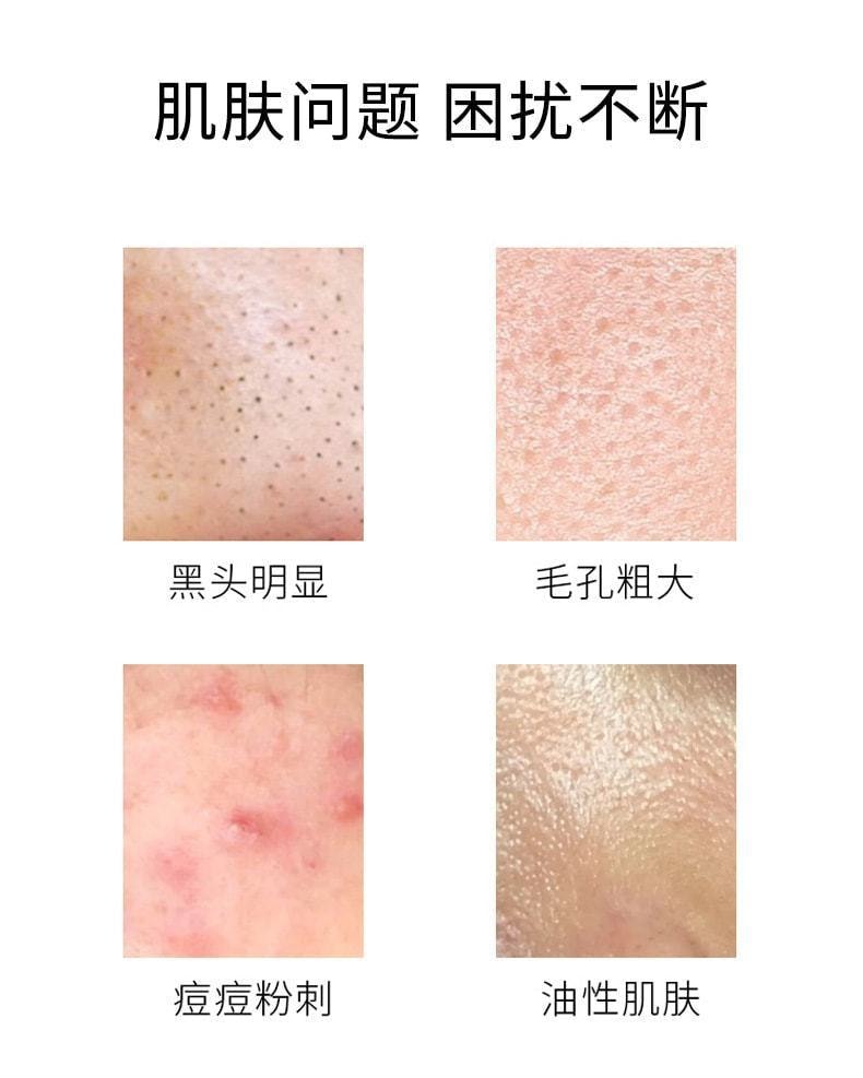 稚漾 壬二酸淨顏凝露水楊酸細緻毛孔霜去黑頭緊緻毛孔 淨顏凝露30g+毛孔細緻霜30g(限時低價促銷)