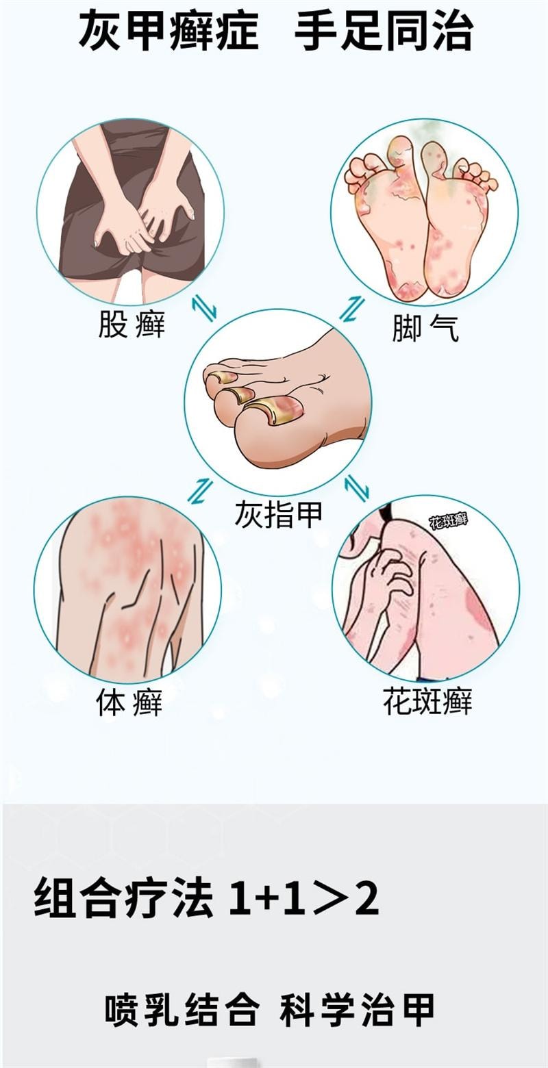 【中国直邮】 洛芙 环吡酮胺乳膏 抑制真菌 强力渗透 治疗灰指甲专用药 15g x 1盒