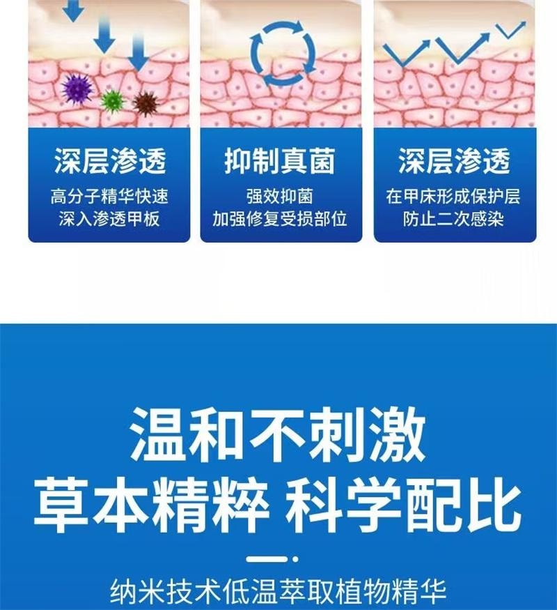 祥医堂 灰指甲专用液体 阿莫罗芬灰甲搽剂乳膏软膏5ml