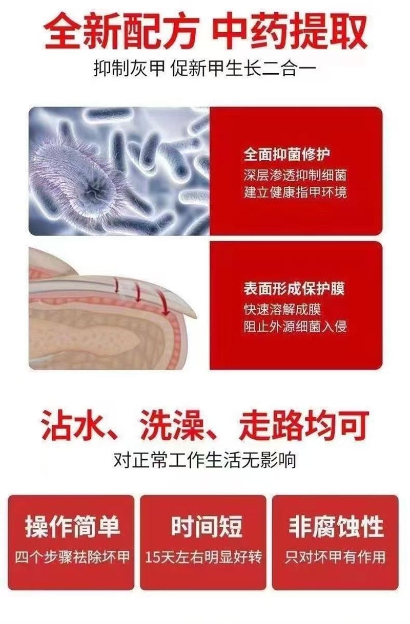 祥医堂 灰指甲专用液体 阿莫罗芬灰甲搽剂乳膏软膏5ml