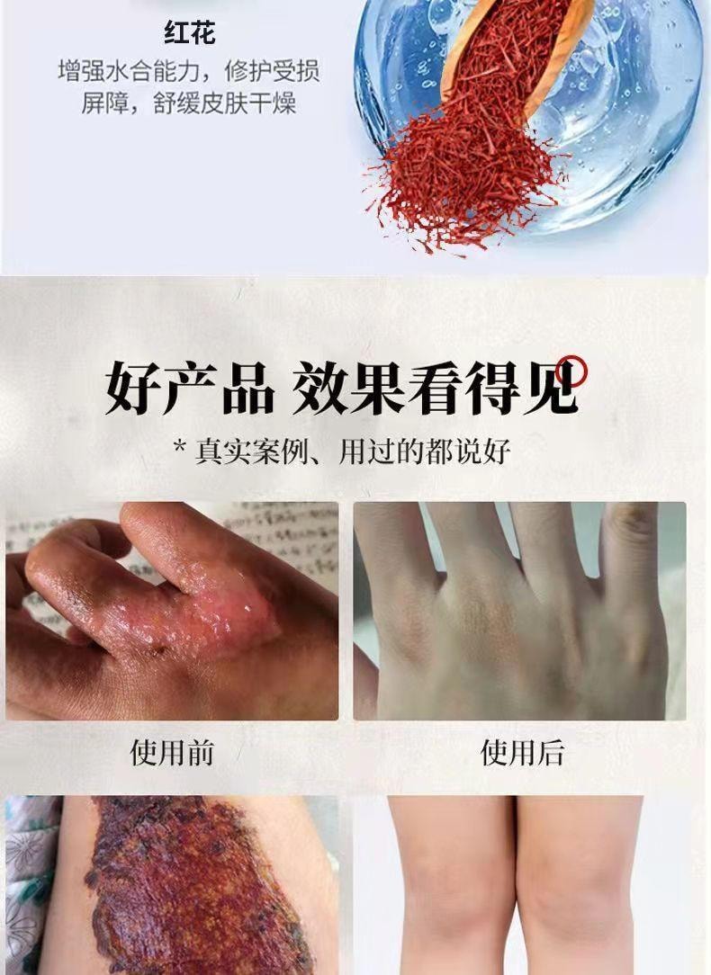 祥医堂 獾油烫伤膏15g/盒 修护皮肤、止痛消肿、温和舒缓、烫伤烧伤疤痕膏