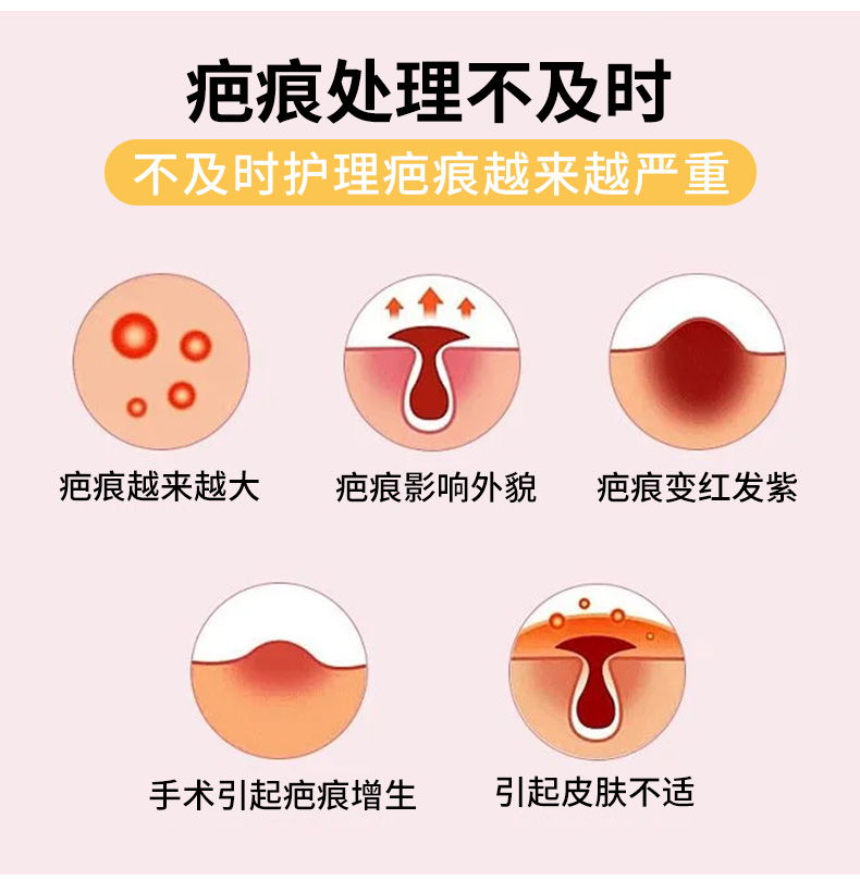 修正 疤痕霜 祛疤祛痘印 燒傷燙傷疤痕痘印修復神器  20g/支(小紅書種草推薦)