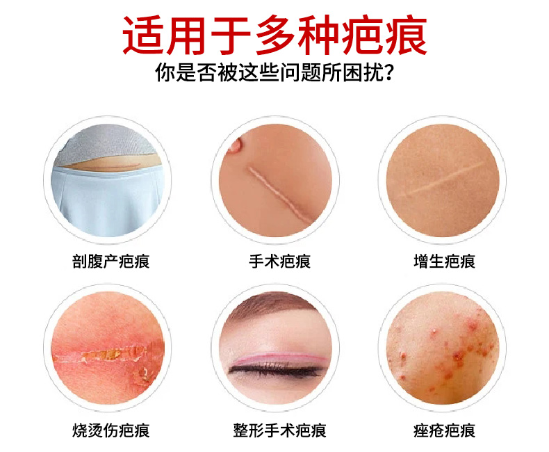 修正 疤痕霜 祛疤祛痘印 燒傷燙傷疤痕痘印修復神器  20g/支(小紅書種草推薦)