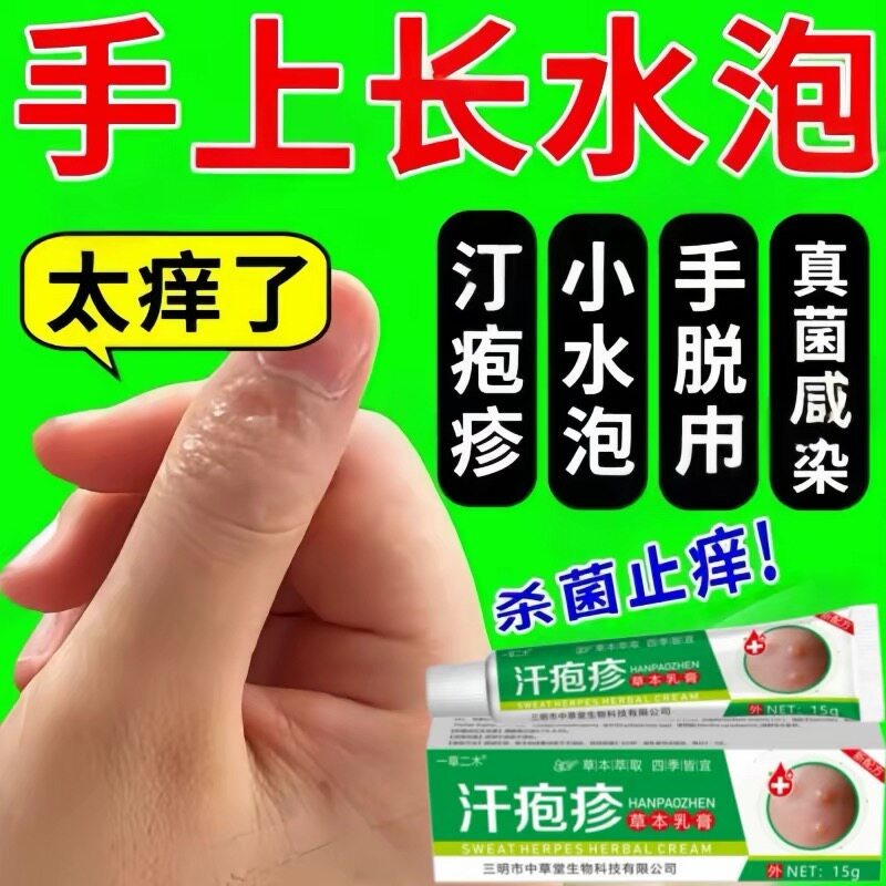 Anti-itch cream specifically for dyshidrotic eczem 15 g - Weee!