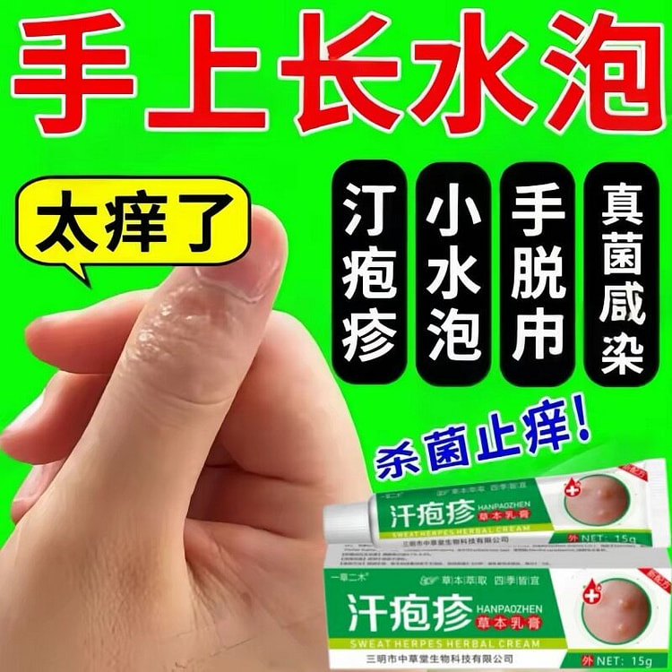 Anti-itch cream specifically for dyshidrotic eczem 15 g