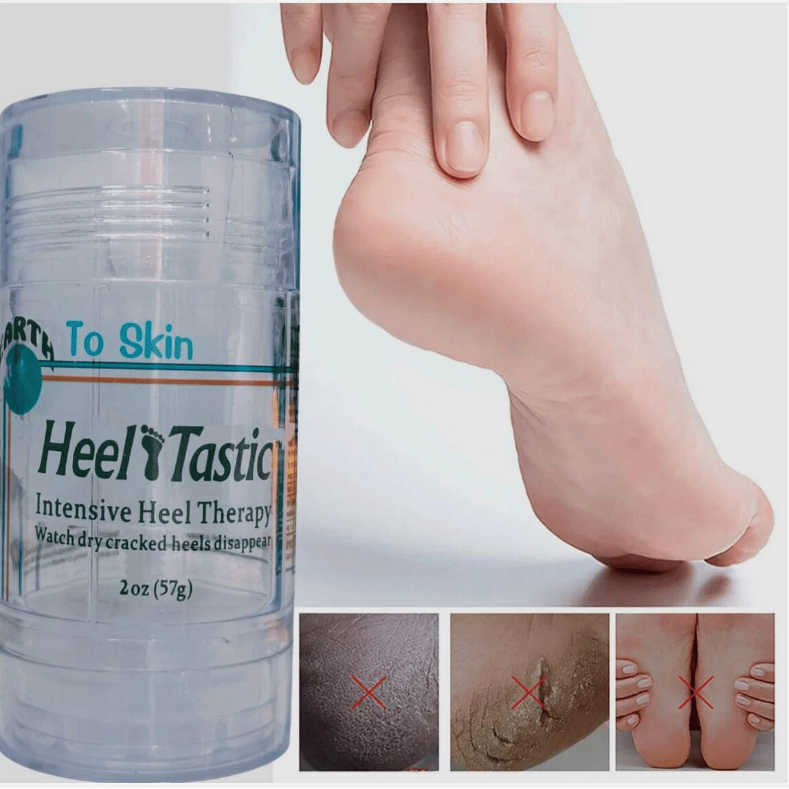 Heel Tastic Intensive Heel Therapy Foot Care 2oz N 1 pack