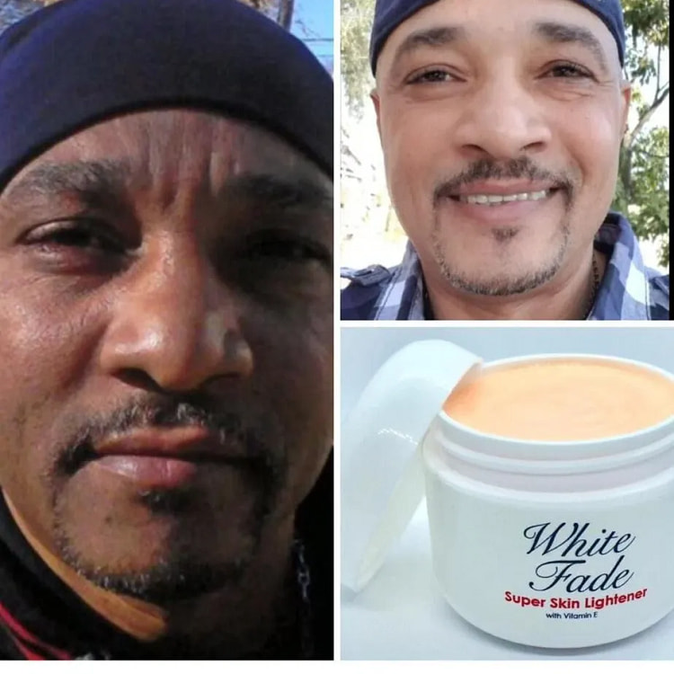 White Fade Super Skin Lightener Cream, Para Piel T 1 box