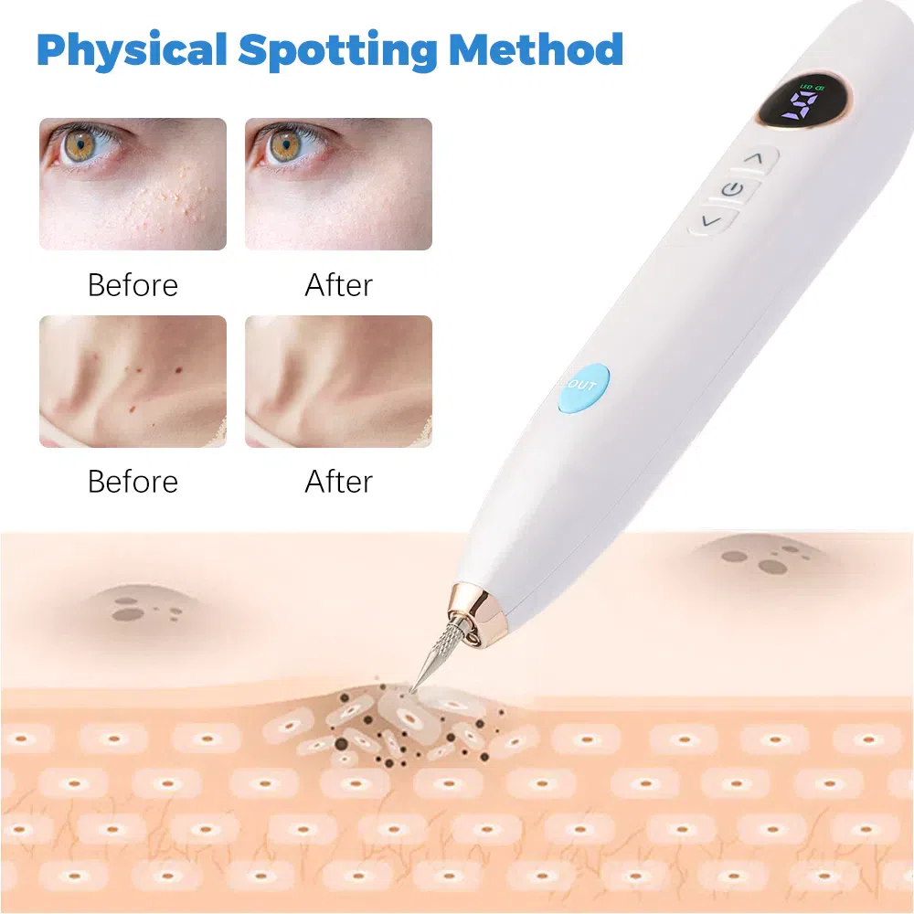 Laser Skin Tag Remover Face Mole Remove Plasma Pen Freckle Removal Machine Plasma Remove Scar Black Spot Face Wart Tattoo Device 1 each