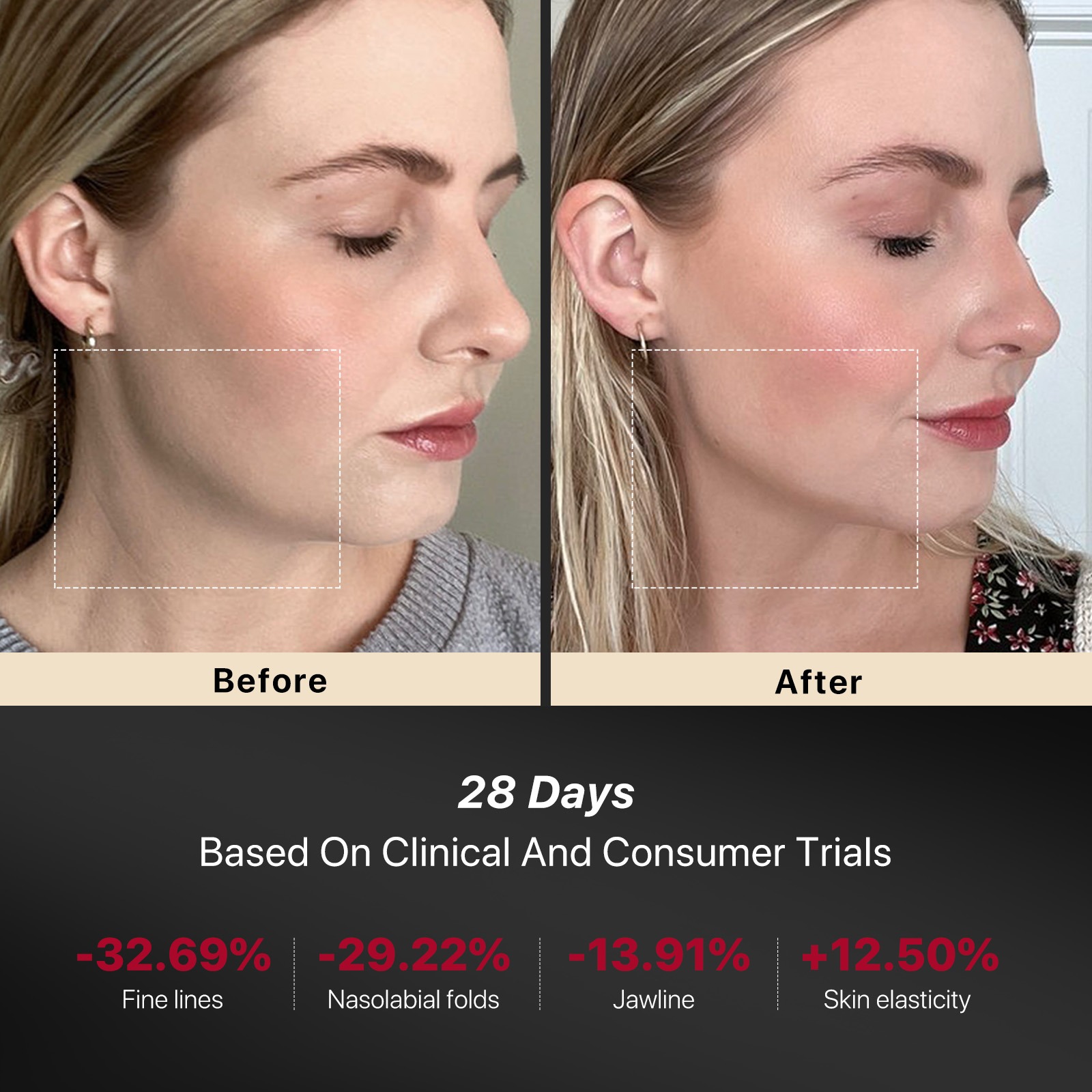 Get AMIRO R1 PRO Facial RF Skin Tightening Device Black with 70ml