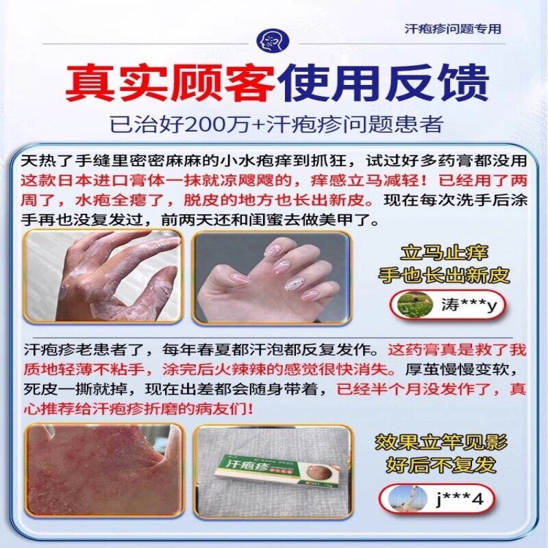 Anti-itch cream specifically for dyshidrotic eczem 15 g - Weee!