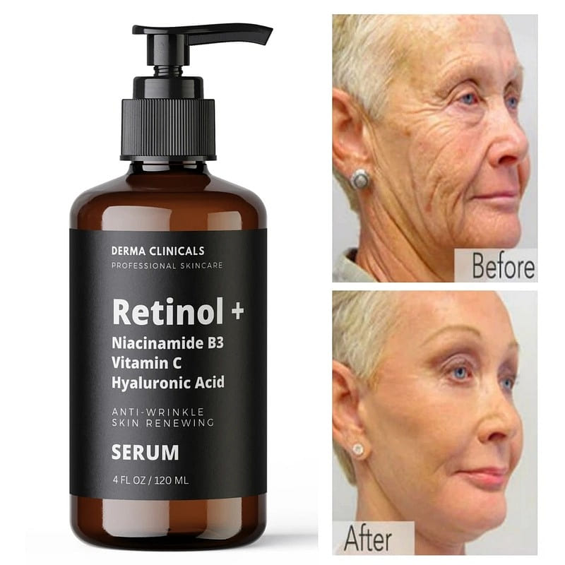 Retinol, Niacinamide, Vitamin C, Hyaluronic Acid 4 fl.oz