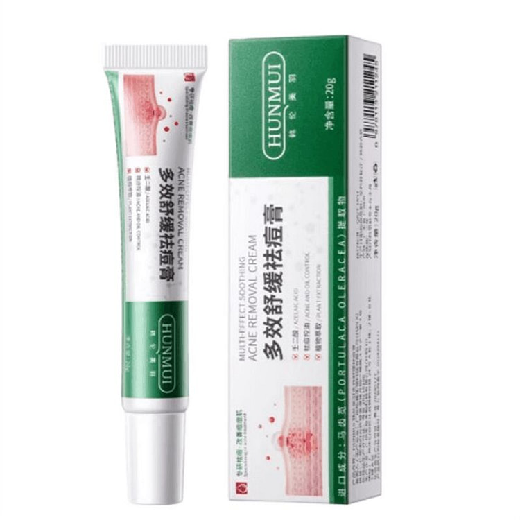韩伦美羽 多效舒缓祛痘膏  20g/盒 1 盒