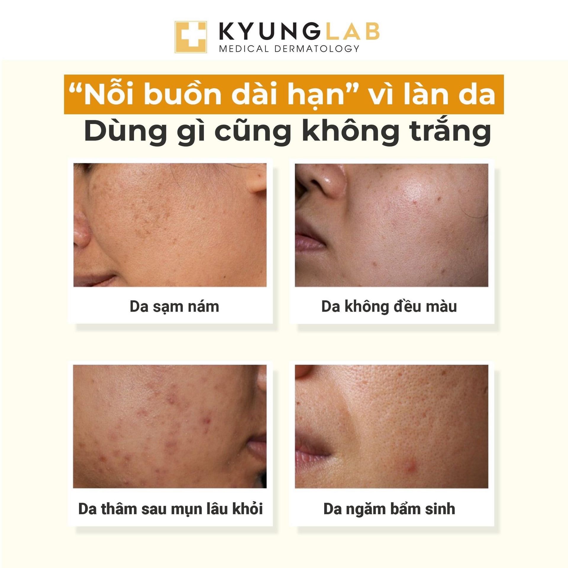 Get Kyung Lab Renewal TRX Pigment Control Ampoule Delivered | Weee