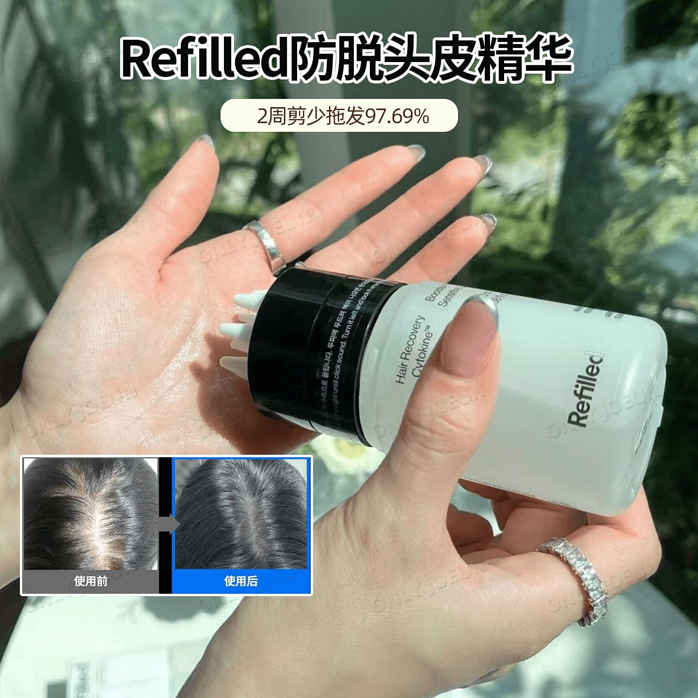 Refilled Anti-Hair Loss Scalp Essence 100ml 100 ml