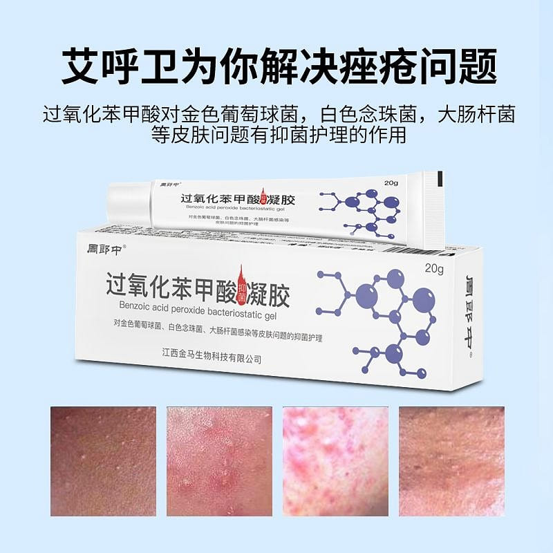 Bacteriostasis of benzoic peroxide gel 20 g