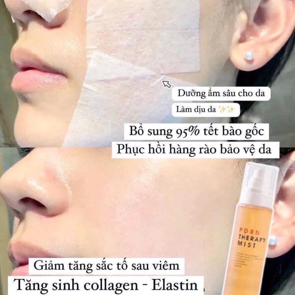 Get Kyung Lab Renewal PDRN Therapy Anti Aging Mist Delivered